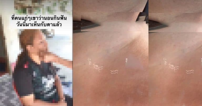 Verification : Dentists and Academics Confirm: “Tooth Worms” Do Not Exist!