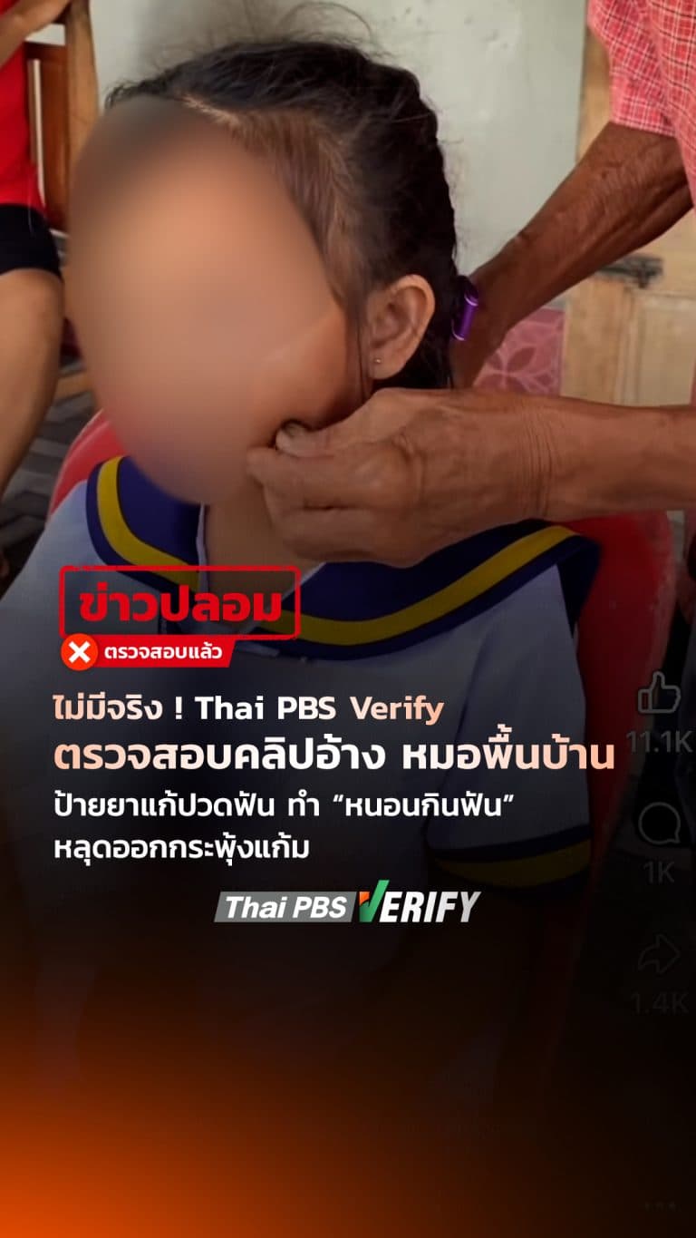 ไม่มีจริง ! Thai PBS Verify ตรวจสอบคลิปอ้าง หมอพื้นบ้านป้ายยาแก้ปวดฟัน ทำ “หนอนกินฟัน” หลุดออกกระพุ้งแก้ม : Thai PBS Verify